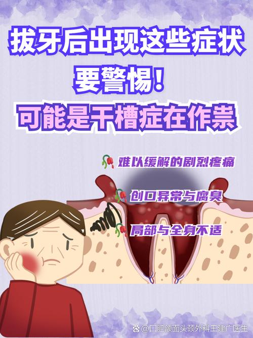 拔牙术后不适处理_干槽症症状与预防_梦见被医生拔牙
