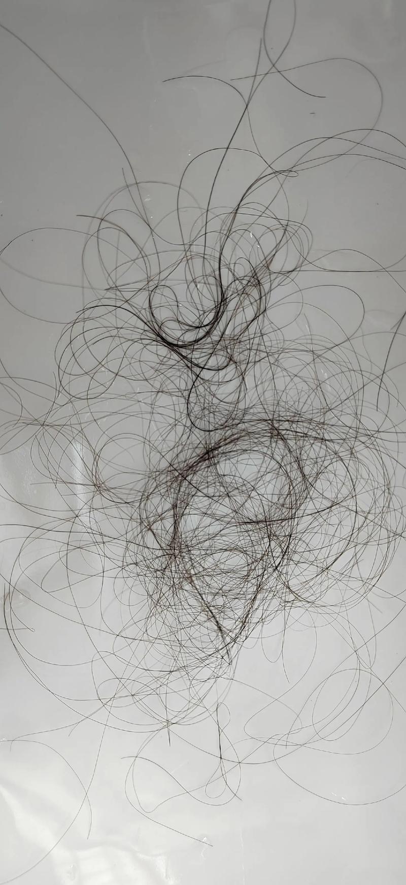 梦见自己头皮揭开流血_梦见梳头掉头发的寓意_女人梦见掉头发的吉凶预兆