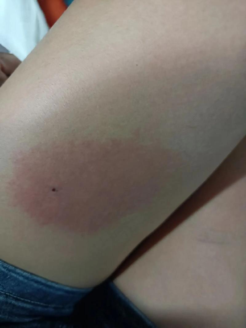 梦见自己被马蜂蛰_梦见被马蜂蛰的预示_梦见自己被蜂蛰